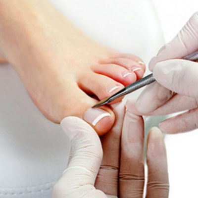 Servicios - Podólogo en Málaga